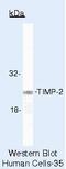 TIMP Metallopeptidase Inhibitor 2 antibody, MA5-12207, Invitrogen Antibodies, Western Blot image 