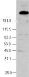 Nuclear Receptor Corepressor 2 antibody, ab24551, Abcam, Western Blot image 