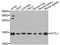 Coactosin Like F-Actin Binding Protein 1 antibody, STJ23203, St John