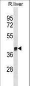 Arginase 1 antibody, LS-C155915, Lifespan Biosciences, Western Blot image 