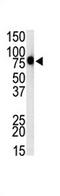 Toll Like Receptor 1 antibody, AP11524PU-N, Origene, Western Blot image 