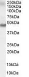 Retinoic acid receptor alpha antibody, TA303003, Origene, Western Blot image 