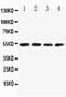 Programmed Cell Death 4 antibody, PA2251, Boster Biological Technology, Western Blot image 