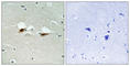 Activating Transcription Factor 2 antibody, abx012670, Abbexa, Western Blot image 