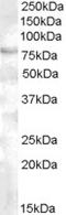 Forkhead Box P2 antibody, STJ70076, St John