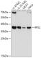 40S ribosomal protein S2 antibody, GTX33477, GeneTex, Western Blot image 