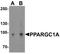 PPARG Coactivator 1 Alpha antibody, A00236, Boster Biological Technology, Western Blot image 