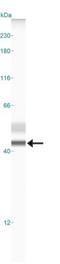 Triggering Receptor Expressed On Myeloid Cells 2 antibody, NBP1-07101, Novus Biologicals, Western Blot image 