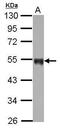 Coagulation Factor III, Tissue Factor antibody, PA5-27278, Invitrogen Antibodies, Western Blot image 
