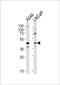 GGN antibody, PA5-49325, Invitrogen Antibodies, Western Blot image 