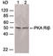 Protein Kinase CAMP-Dependent Type I Regulatory Subunit Beta antibody, LS-B14104, Lifespan Biosciences, Western Blot image 