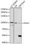 ENAH Actin Regulator antibody, 18-163, ProSci, Western Blot image 
