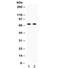 Frizzled Class Receptor 1 antibody, R32354, NSJ Bioreagents, Western Blot image 