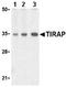 TIR Domain Containing Adaptor Protein antibody, ab17218, Abcam, Western Blot image 