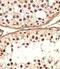 Defensin Beta 107B antibody, PA5-49353, Invitrogen Antibodies, Immunohistochemistry paraffin image 