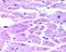 HIF-2-alpha antibody, NB100-122B, Novus Biologicals, Immunohistochemistry frozen image 
