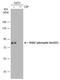 Ribosomal Protein S6 Kinase A3 antibody, GTX133470, GeneTex, Western Blot image 