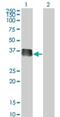 SIX Homeobox 2 antibody, H00010736-M01, Novus Biologicals, Western Blot image 