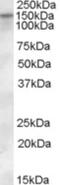 Solute Carrier Family 12 Member 4 antibody, NBP1-06043, Novus Biologicals, Western Blot image 