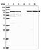 Kinesin Light Chain 1 antibody, PA5-62613, Invitrogen Antibodies, Western Blot image 