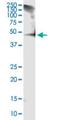 Reticulocalbin 1 antibody, H00005954-M01, Novus Biologicals, Western Blot image 