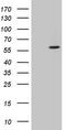 Casein Kinase 1 Gamma 1 antibody, LS-C790892, Lifespan Biosciences, Western Blot image 
