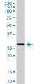 Ribose 5-Phosphate Isomerase A antibody, H00022934-D01P, Novus Biologicals, Western Blot image 