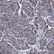Calcium Binding And Coiled-Coil Domain 2 antibody, HPA023195, Atlas Antibodies, Immunohistochemistry paraffin image 