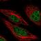 Mono-ADP Ribosylhydrolase 1 antibody, NBP2-58835, Novus Biologicals, Immunofluorescence image 