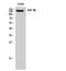 Insulin Like Growth Factor 1 Receptor antibody, STJ93657, St John