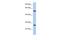 Zinc Finger Protein 10 antibody, A12837, Boster Biological Technology, Western Blot image 