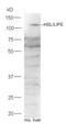 Lipase E, Hormone Sensitive Type antibody, GTX37663, GeneTex, Western Blot image 