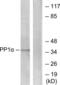 Protein Phosphatase 1 Catalytic Subunit Alpha antibody, LS-C117778, Lifespan Biosciences, Western Blot image 