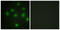 Tousled Like Kinase 1 antibody, LS-B9860, Lifespan Biosciences, Immunofluorescence image 