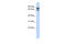 Solute Carrier Family 6 Member 15 antibody, ARP43982_P050, Aviva Systems Biology, Western Blot image 