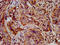 SH3 And Multiple Ankyrin Repeat Domains 2 antibody, LS-C675063, Lifespan Biosciences, Immunohistochemistry paraffin image 