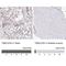 Tim1 antibody, NBP2-32559, Novus Biologicals, Immunohistochemistry paraffin image 