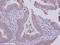 Solute Carrier Family 22 Member 18 Antisense antibody, GTX119059, GeneTex, Immunohistochemistry paraffin image 