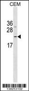 Fibronectin Type III Domain Containing 4 antibody, 59-636, ProSci, Western Blot image 