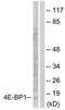 Eukaryotic Translation Initiation Factor 4E Binding Protein 1 antibody, TA326077, Origene, Western Blot image 