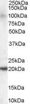 ADP Ribosylation Factor Like GTPase 6 Interacting Protein 5 antibody, STJ70248, St John