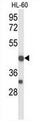 TNF Receptor Superfamily Member 10d antibody, AP54308PU-N, Origene, Western Blot image 