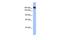 Synaptojanin 1 antibody, GTX47180, GeneTex, Western Blot image 