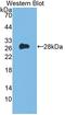 Fms Related Tyrosine Kinase 3 antibody, LS-C373874, Lifespan Biosciences, Western Blot image 