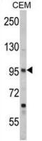 Semaphorin 3A antibody, GTX81310, GeneTex, Western Blot image 