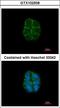 Desmoglein 2 antibody, LS-C185489, Lifespan Biosciences, Immunocytochemistry image 