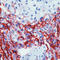 Mesothelioma antibody, LS-C87789, Lifespan Biosciences, Immunohistochemistry frozen image 