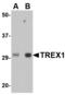 Three Prime Repair Exonuclease 1 antibody, LS-C82903, Lifespan Biosciences, Western Blot image 