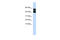 Purinergic Receptor P2X 4 antibody, ARP35512_P050, Aviva Systems Biology, Western Blot image 