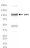 Spliceosome Associated Factor 1, Recruiter Of U4/U6.U5 Tri-SnRNP antibody, NBP2-14836, Novus Biologicals, Western Blot image 